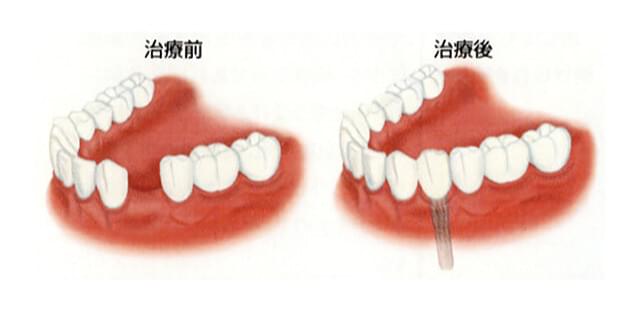 治療前と治療後