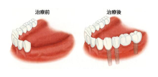 治療前と治療後