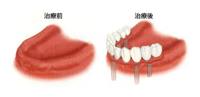 治療前と治療後