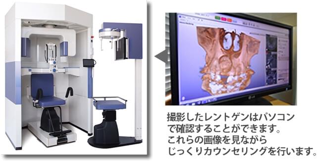 歯科用CT