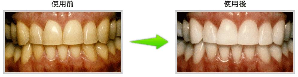 使用前と使用後